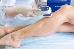 Как проводится лазерная эпиляция