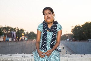 Таинственное заболевание изуродовало лицо 17-летней девушки из Индии