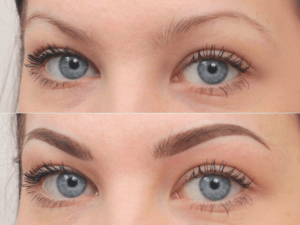 Что представляет собой татуаж бровей волосковым методом