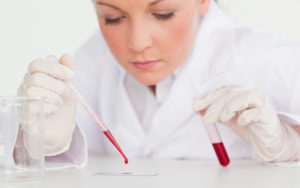 Для чего назначают анализ на ХГЧ?