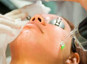 Лазерная шлифовка кожи: показания и противопоказания