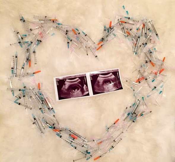 
    5 методик ЭКО: как выбрать подходящую  