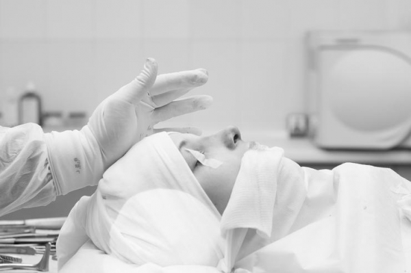 10 ДНЕЙ НА РЕАБИЛИТАЦИЮ. БЕСКРОВНАЯ РИНОПЛАСТИКА ХИРУРГА ТИГРАНА АЛЕКСАНЯНА