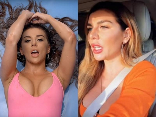 Новости дня: "Пчелы покусали": раздутое лицо Седоковой едва влезло в кадр