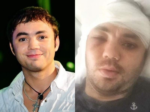 Новости дня: Звезда "Дома-2" разбился в страшном ДТП: опубликовано фото