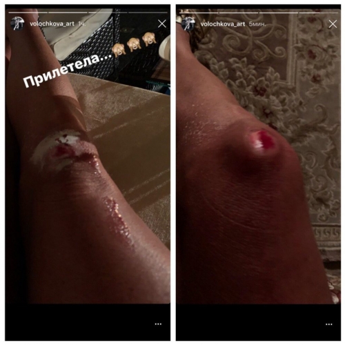 Новости дня: "Снова пьет?": окровавленная Волочкова пыталась разжалобить Сеть