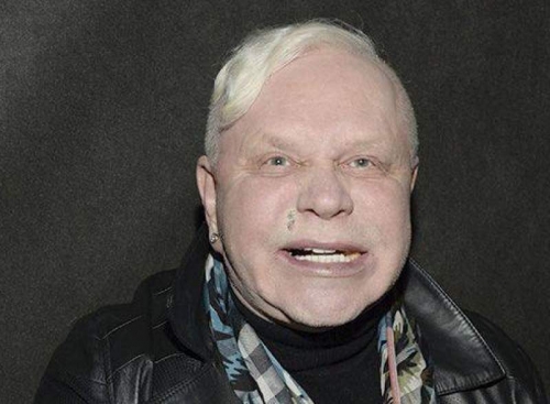 Новости дня: СМИ: Борис Моисеев находится при смерти