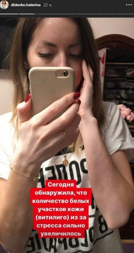 Новости дня: Диденко пожаловалась на неприятную болезнь