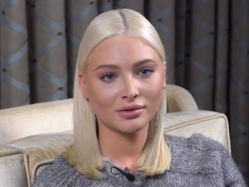 Новости дня: "Повторяет судьбу Началовой": у Алены Шишковой заподозрили страшный диагноз