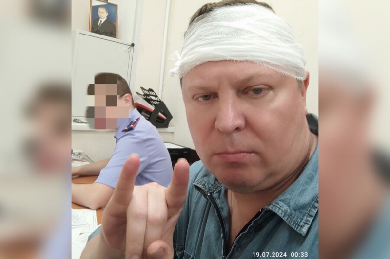 Глава СК Бастрыкин счел нападение на депутата Матвеева покушением на убийство 