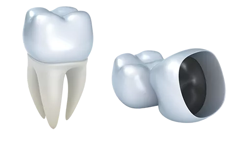 Протезирование зубов: эффективное решение для восстановления улыбки