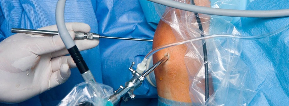 Артроскопия: Современный подход к лечению заболеваний суставов
