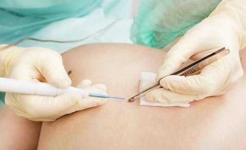 Особенности лечения онкодерматологических заболеваний