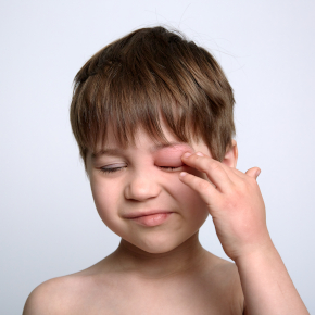 Промывание носослезного канала