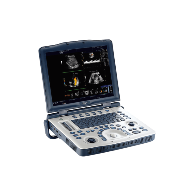 Портативные УЗИ аппараты: незаменимый инструмент в современной диагностике