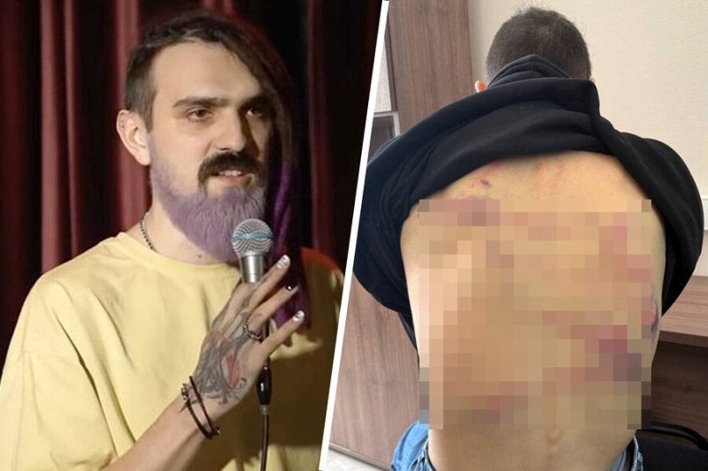 Били дубинками и пытали электрошокером: комик Останин сообщил о зверствах белорусских силовиков 