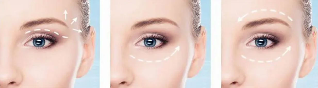 Блефаропластика: взгляд в будущее, молодость в настоящем