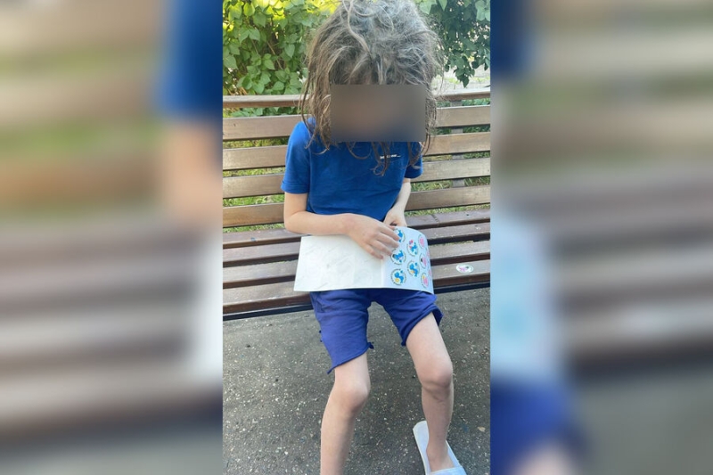 Худой ребенок жил на балконе: в Краснодаре мать годами не выпускала сына-инвалида из дома 