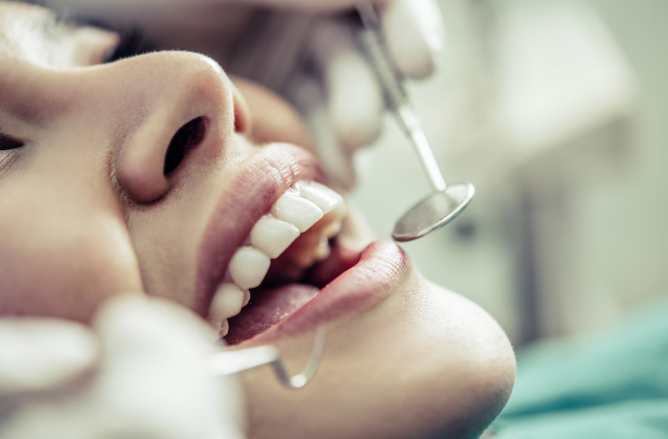Вестибулопластика: искусство формирования здоровой улыбки