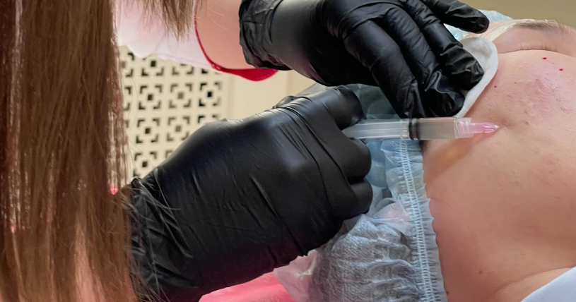 Коллагеностимуляция: путь к молодости и красоте