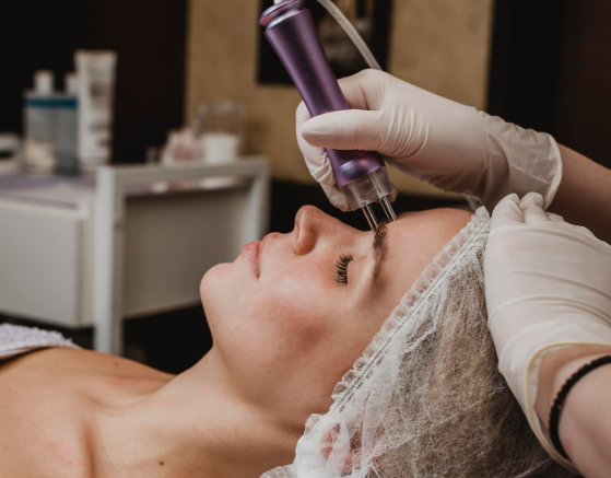 Микроигольчатый RF-лифтинг: новая эра безоперационного омоложения