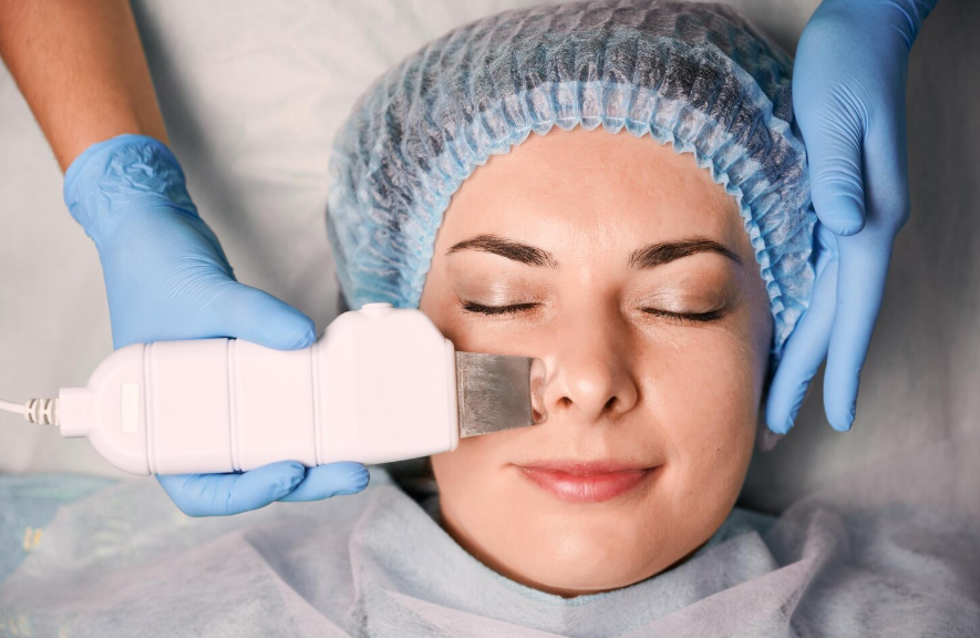 RF-шлифовка: современный подход к коррекции рубцов постакне и выравниванию рельефа кожи